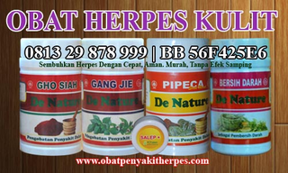 Illustration for article titled Obat Penyakit Herpes Yang Alami